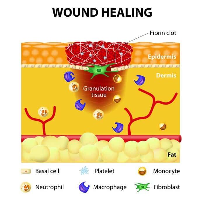 Inflammation